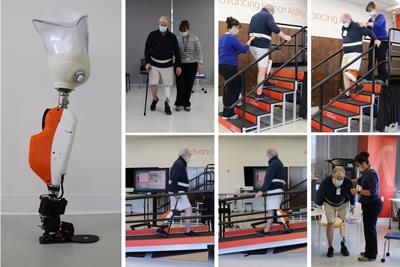 Powered knee and ankle prosthesis use with a K2 level ambulator: a case report